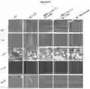 Fig. 43 - Methods and compositions for reducing metastases
