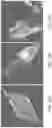 Fig. 49 - CARDIAC MYOFIBRIL INDUCTION