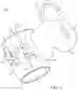 Fig. 08 - Catheter fixing band