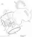 Fig. 09 - Catheter fixing band