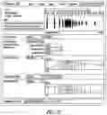 Fig. 09 - User interface for neurostimulation waveform composition