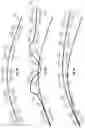 Fig. 08 - Active safety suspension system