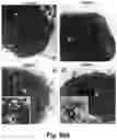 Fig. 65 - CATIONIC POLYMER COATED MESOPOROUS SILICA NANOPARTICLES AND USES THEREOF