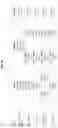 Fig. 44 - Separation of VWF and VWF propeptide by chromatographic methods