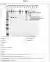 Fig. 87 - Separation of VWF and VWF propeptide by chromatographic methods