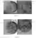 Fig. 02 - Additive for soil conditioning and an agricultural composition containing said additive for plant growth