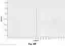 Fig. 71 - ABERRANT MITOCHONDRIAL DNA, ASSOCIATED FUSION TRANSCRIPTS AND HYBRIDIZATION PROBES THEREFOR