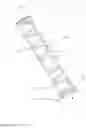 Fig. 02 - Spring assembly having a coil spring and an anti-entanglement element