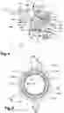 Fig. 04 - Combustion module for a gas turbo engine with chamber bottom stop