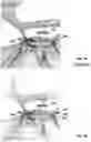 Fig. 06 - Selective peripheral vision filtering in a foveated rendering system