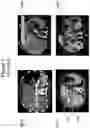 Fig. 02 - Automatic liver segmentation in CT