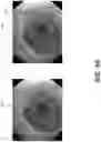 Fig. 09 - Systems and methods for processing real-time video from a medical image device and detecting objects in the video