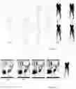 Fig. 08 - Parameterized model of 2D articulated human shape