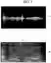 Fig. 08 - Artificial intelligence device for learning deidentified speech signal and method therefor
