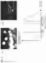 Fig. 04 - Imaging device and focus adjustment method using an index representing bokeh state