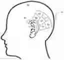 Fig. 01 - Neutralizing the effect of a medical device location