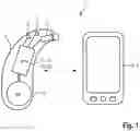 Fig. 02 - METHOD FOR CONTROLLING THE TRANSMISSION OF DATA BETWEEN AT LEAST ONE HEARING AID AND A PERIPHERAL DEVICE OF A HEARING AID SYSTEM AND ALSO A HEARING AID