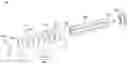 Fig. 01 - Heat dissipation device