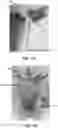 Fig. 13 - METHOD OF PRODUCING PATHOGEN-FREE CANNABIS PLANTS AND PATHOGEN-FREE PLANTS AND CLONES PRODUCED THEREFROM