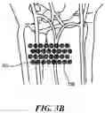 Fig. 06 - Methods and system for multi-channel bio-optical sensing