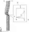 Fig. 07 - BLOOD PRESSURE MEASUREMENT APPARATUS, METHOD, AND PROGRAM