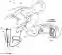 Fig. 01 - Intravenous line flow sensor for advanced diagnostics and monitoring in emergency medicine