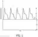 Fig. 02 - Detecting erythema caused by wearable devices