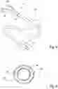 Fig. 04 - METHOD AND APPARATUS FOR ENDOBRONCHIAL DIAGNOSIS