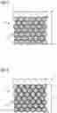 Fig. 03 - Method for producing a grid-like beam collimator, grid-like beam collimator comprising a grid structure having metal particles and a cured stiffening material, radiation detector, and medical imaging device