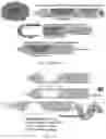 Fig. 07 - Biopsy system for enhanced tissue harvesting