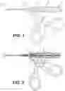 Fig. 02 - TISSUE REMOVAL DEVICES AND RELATED METHODS