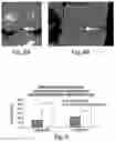 Fig. 09 - Methods and procedures for ligament repair