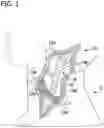 Fig. 02 - METHODS AND SYSTEMS OF POSITIONING AN IMPLANT