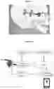 Fig. 02 - SYSTEMS AND METHODS FOR CONTACTLESS CRANIO-MAXILLO-FACIAL DISTRACTION