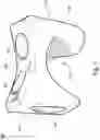 Fig. 02 - Interpedicular Spacer