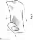 Fig. 03 - Interpedicular Spacer