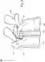 Fig. 05 - Interpedicular Spacer