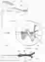 Fig. 14 - SURGICAL ROBOTIC AUTOMATION WITH TRACKING MARKERS