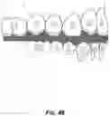 Fig. 49 - Direct 3D-printed orthodontic aligners with torque, rotation, and full control anchors
