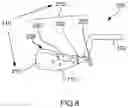 Fig. 07 - Bendable impression tray and method of taking an impression therewith