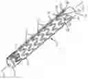 Fig. 01 - STENT HAVING FLEXIBLY CONNECTED ADJACENT STENT ELEMENTS