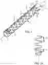 Fig. 02 - STENT HAVING FLEXIBLY CONNECTED ADJACENT STENT ELEMENTS