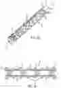 Fig. 04 - STENT HAVING FLEXIBLY CONNECTED ADJACENT STENT ELEMENTS