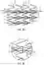 Fig. 06 - STENT HAVING FLEXIBLY CONNECTED ADJACENT STENT ELEMENTS