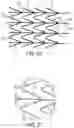 Fig. 08 - STENT HAVING FLEXIBLY CONNECTED ADJACENT STENT ELEMENTS