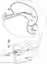 Fig. 19 - FLOATING GASTROINTESTINAL ANCHOR