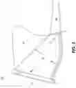Fig. 02 - NON-INVASIVE URINE COLLECTION DEVICE