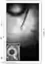 Fig. 08 - Auxiliary surgical field visualization system