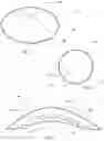 Fig. 02 - Methods for treating eye disorders using ocular implants