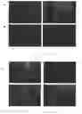 Fig. 07 - Pharmaceutical Composition for Treating Cancer Comprising Trypsinogen and/or Chymotrypsinogen and an Active Agent Selected from a Selenium Compound, a Vanilloid Compound and a Cytoplasmic Glycolysis Reduction Agent